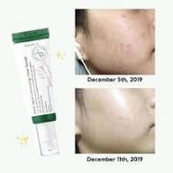 Dark Spot Correcting Glow Serum